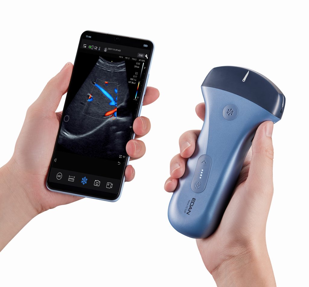 Edan Nano C5 EXP