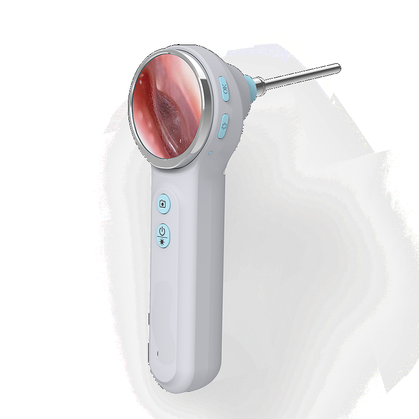 RAE 500 Portable Smart Otoscope